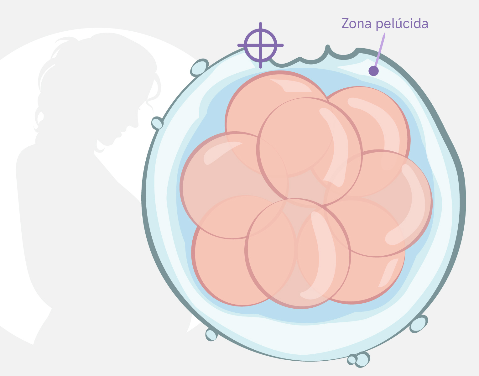 Graficos_Hatching-Asistido