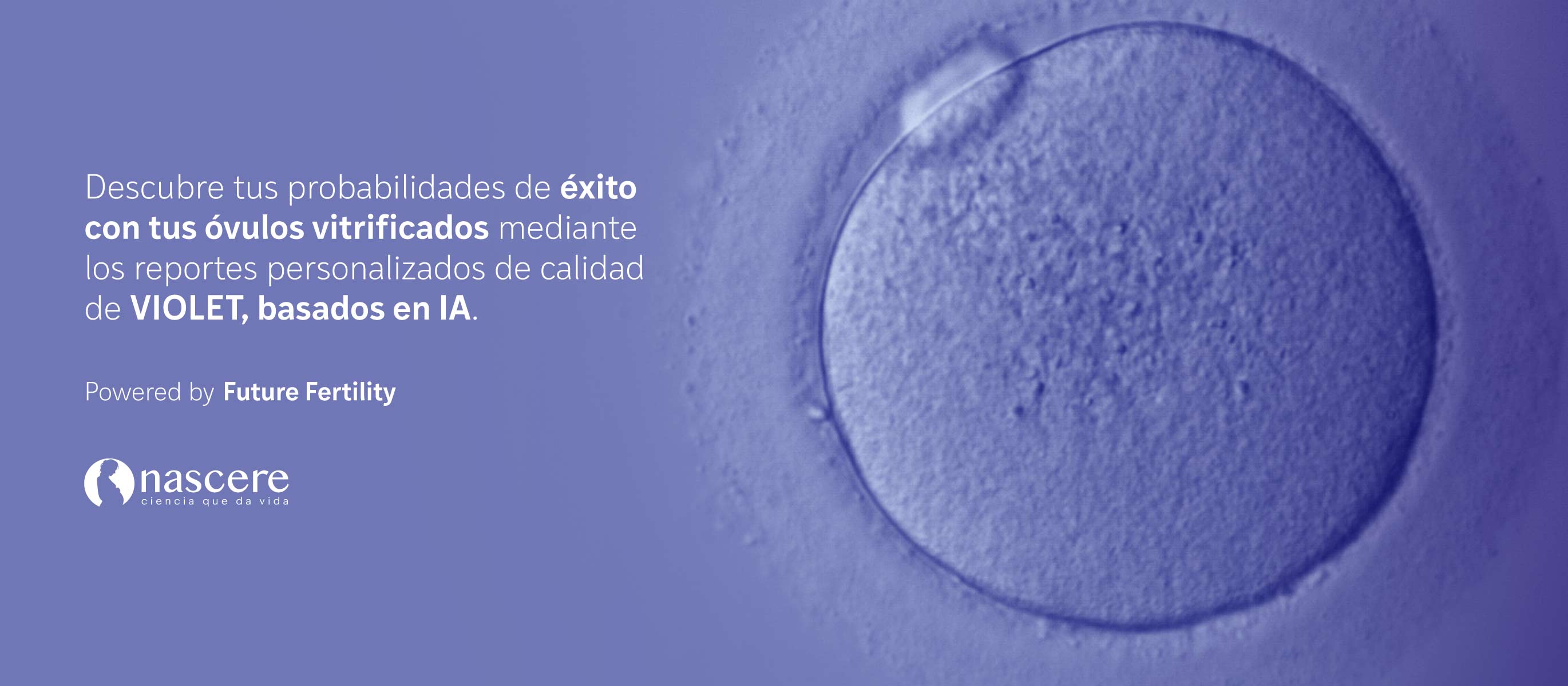 NAS_banner violeta-esp